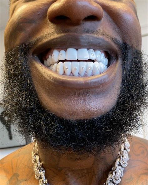 gucci mane diamond teeth